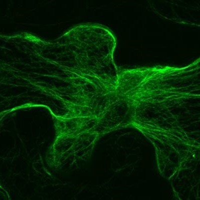 Actin filaments, seen under a microscope. Green threads on a black background