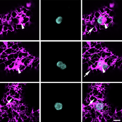 Six confocal images of tobacco, three showing expression of VAP27-1 and VAP27-3, three showing chloroplasts, and three showing those images merged. 